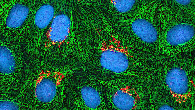 Upstream Bioprocess Technology Part 1